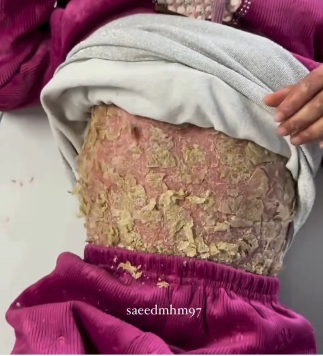 Mosab Abu Toha tweet media