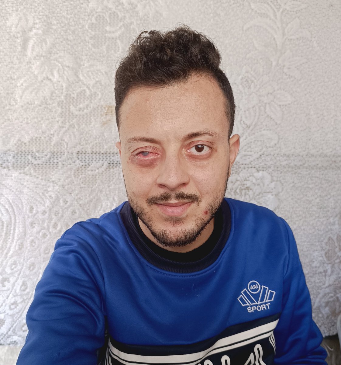ahmedshameya995's tweet photo. Waiting for the doctor to call me to remove my eye. 

Please pray for me. 
https://t.co/GJsRia72F1 https://t.co/8to4KFqQFQ