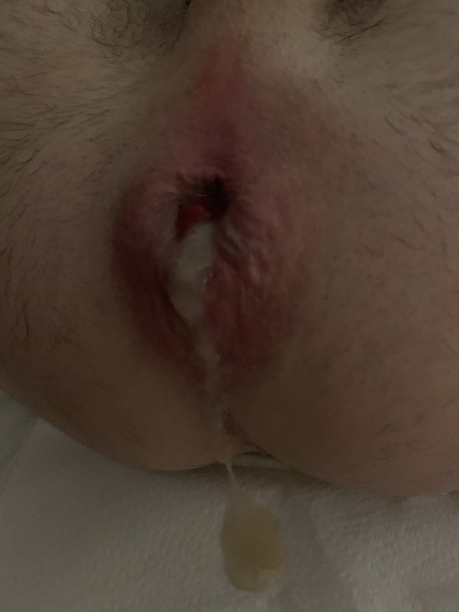 UKAsianTOP's tweet photo. Love to see cum dripping out from the hole! #AsianTop #WhiteBottom #LondonGay https://t.co/GoXSZO4P0k