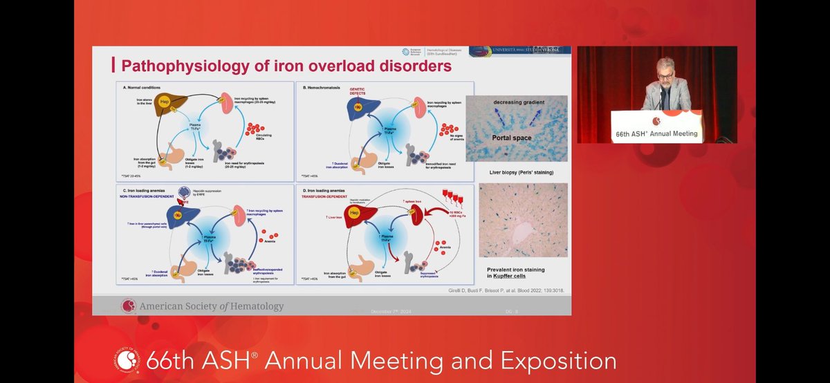 Domenico Girelli (@digigi60) on Twitter photo Some 30 y ago I was fascinated by my first #ASH Meeting. Couldnât imagine having later the privilege of serving the haematological community with an educational lecture. #ASH24 <a href="/UniVerona/">UniversitĂ di Verona</a> <a href="/SIMI_MedInt/">SIMI SocietĂ Italiana Medicina Interna</a> <a href="/ERNEuroBloodNet/">ERN EuroBloodNet</a> <a href="/EHA_Hematology/">European Hematology Association</a> <a href="/ironoverloadUS/">Hemochromatosis United States</a> Some 30 y ago I was fascinated by my first #ASH Meeting. Couldnât imagine having later the privilege of serving the haematological community with an educational lecture. #ASH24 <a href="/UniVerona/">UniversitĂ di Verona</a> <a href="/SIMI_MedInt/">SIMI SocietĂ Italiana Medicina Interna</a> <a href="/ERNEuroBloodNet/">ERN EuroBloodNet</a> <a href="/EHA_Hematology/">European Hematology Association</a> <a href="/ironoverloadUS/">Hemochromatosis United States</a>