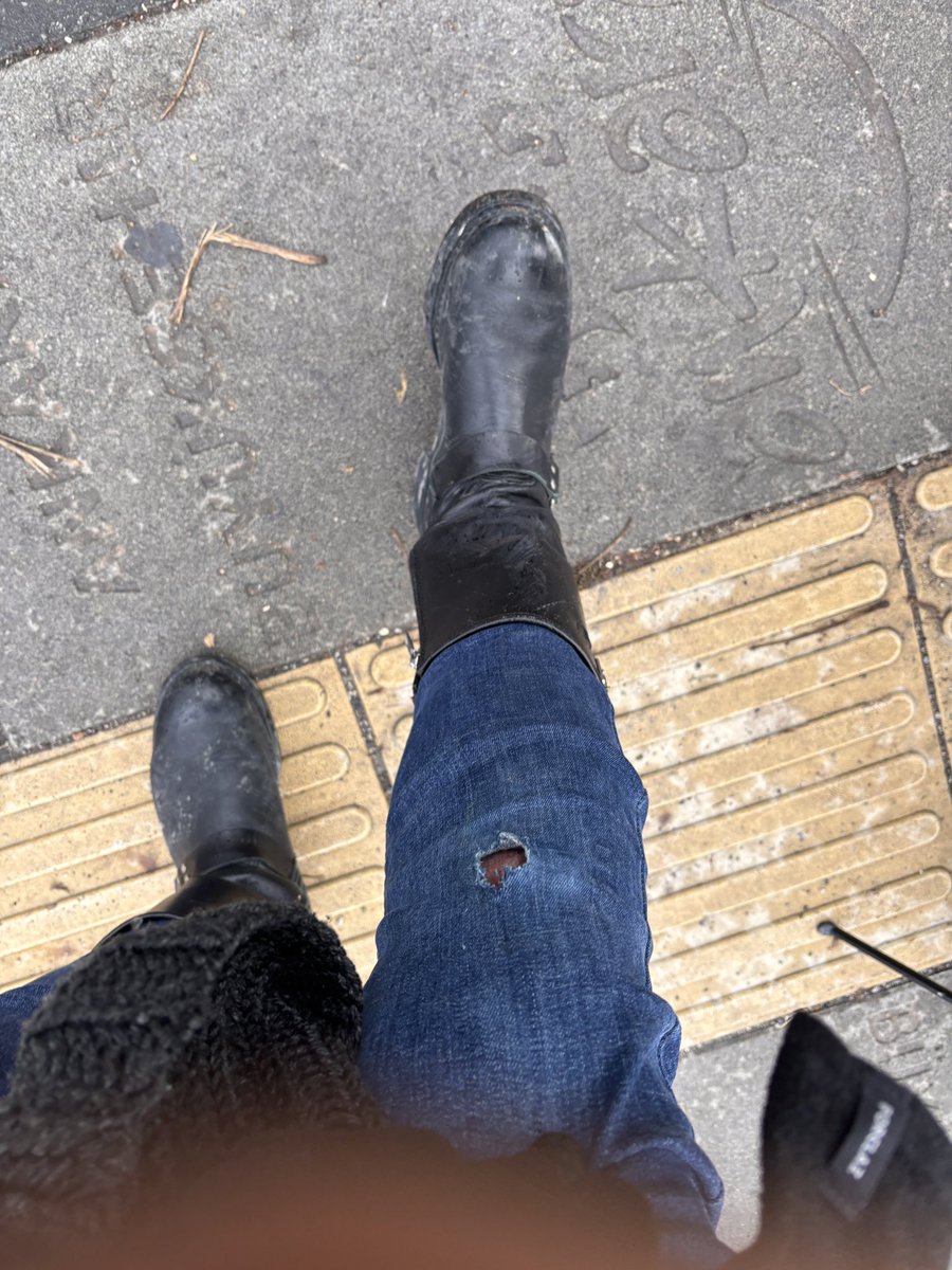bahadircagri's tweet photo. Bugün @cankayabelediye işini yapmadığı için köpek saldırısı sonucu düşerek kaza geçirdim @KopekSorunu https://t.co/zomEt9cv17