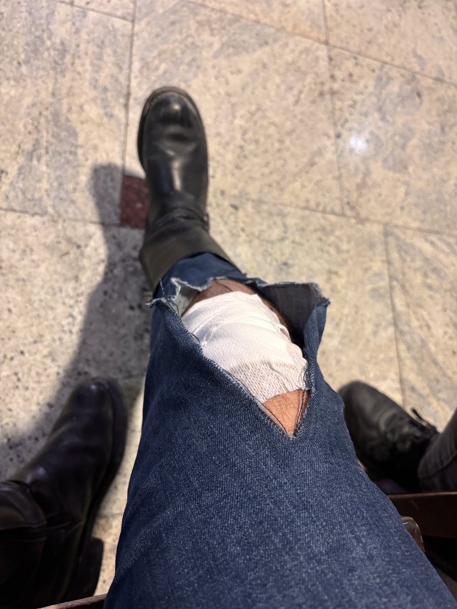 bahadircagri's tweet photo. Bugün @cankayabelediye işini yapmadığı için köpek saldırısı sonucu düşerek kaza geçirdim @KopekSorunu https://t.co/zomEt9cv17