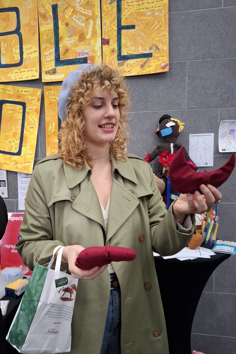 InvisWarriorSCD's tweet image. This amazing visitor at the #ImperialLates learned at our stand about the difference between a normal, round-shaped red blood cell, and a stiff #sicklecell red blood cell. And then they went to explain what they had learned to their friend! 💛 Impressed💛 #sicklecellawareness