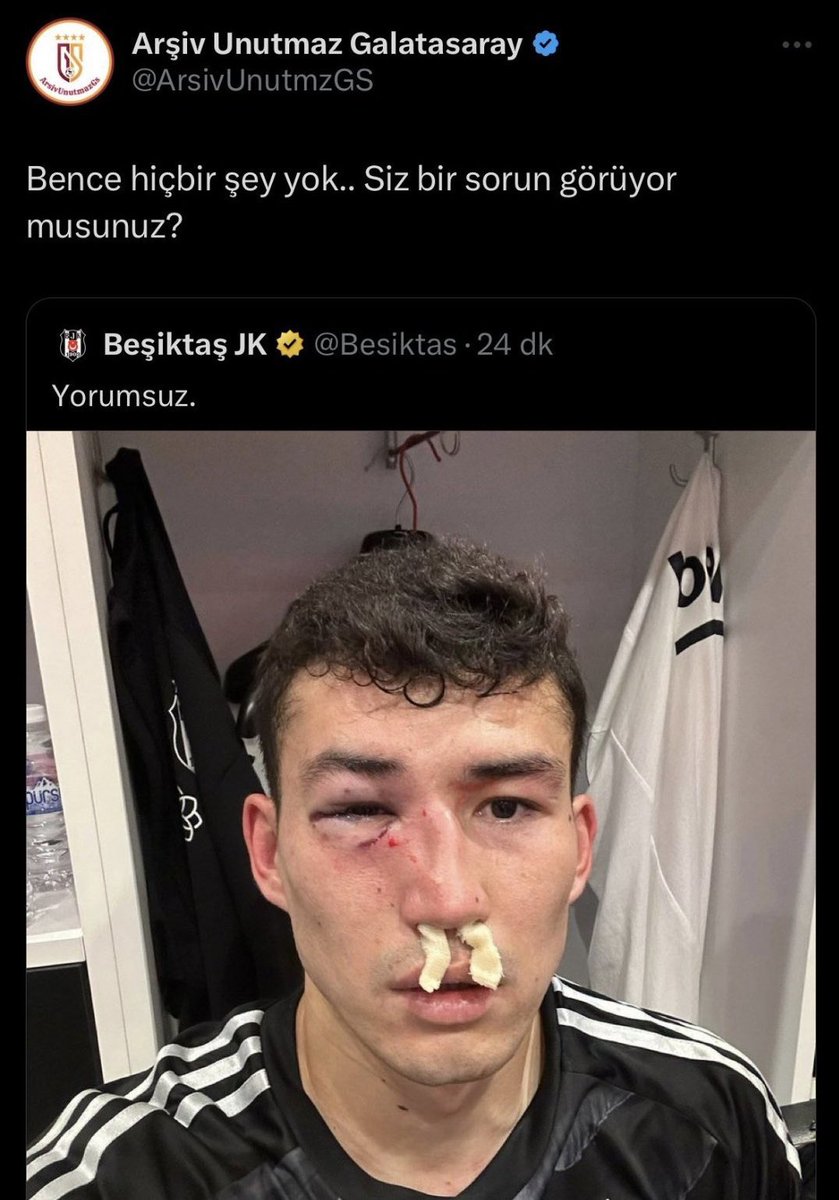 bunuda unutmayalım olur mu