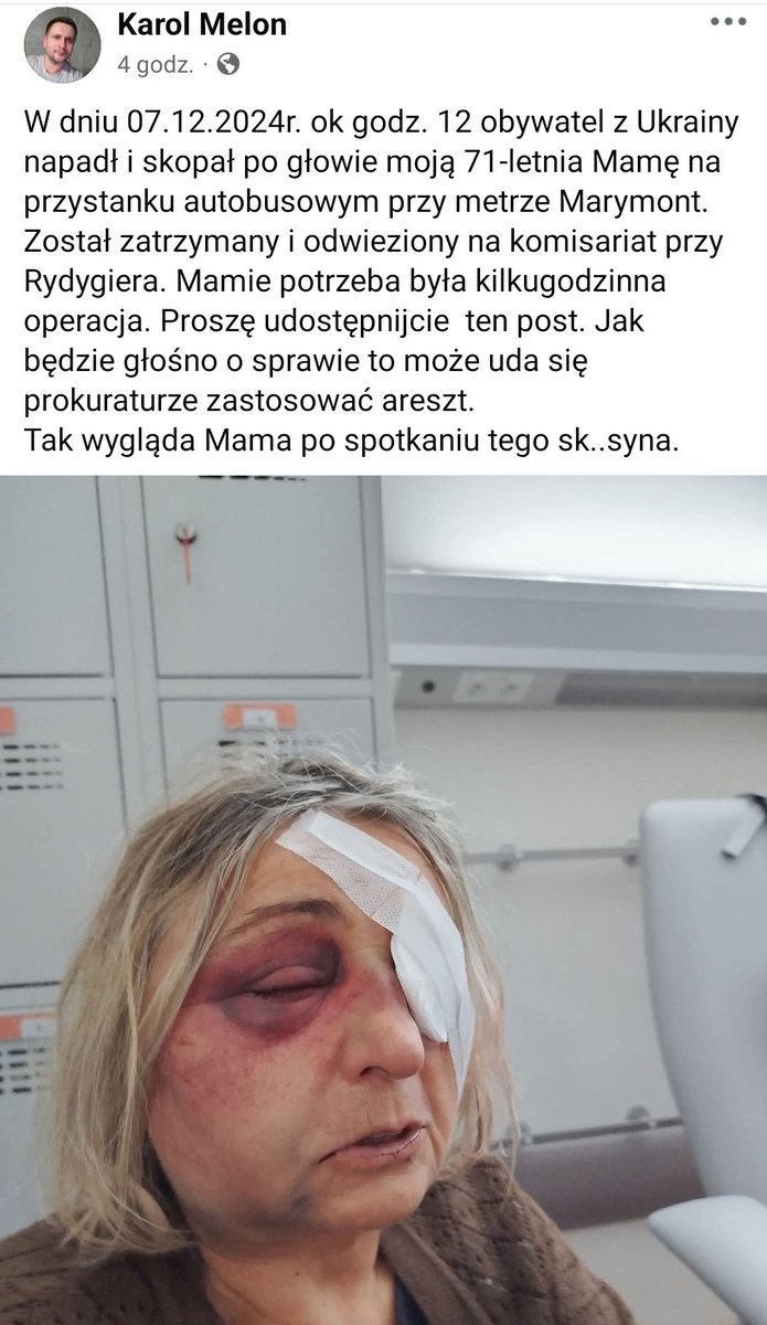 Ukrainiec skopał po głowie 71 letnią kobietę..