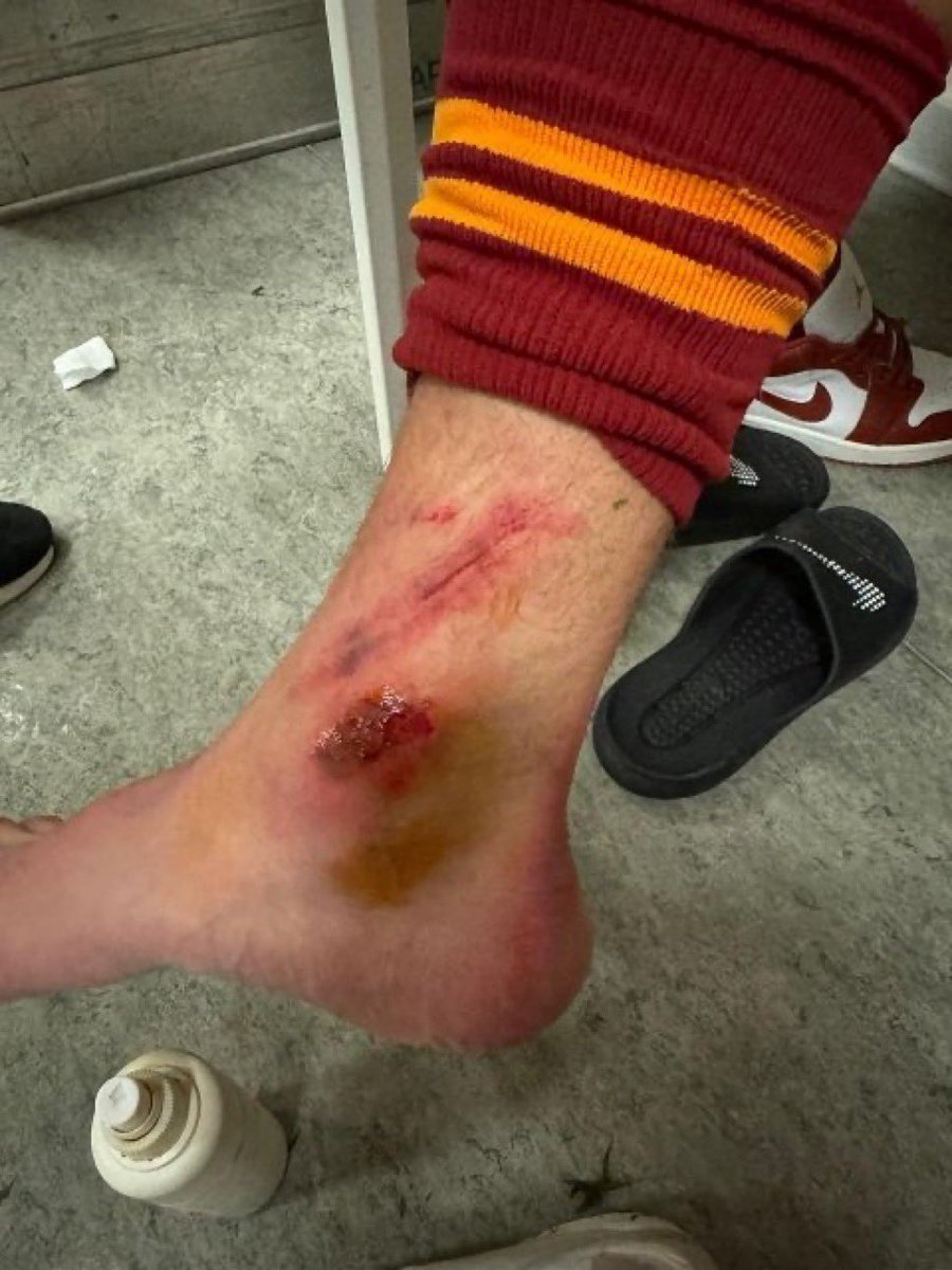 bence hiçbir şey yok.. siz bir sorun görüyor musunuz?