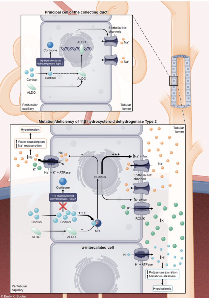 DukeKidney's tweet photo. New ASN Kidney News series of articles by APD Dr Raslan and colleagues is out

Revealing Physiology Through Pathophysiology

https://t.co/1cu2NqJNZL https://t.co/BRF83cVuZF