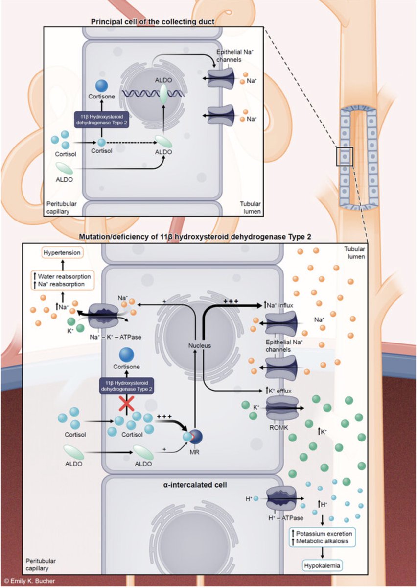 New ASN Kidney News series of articles by APD Dr Raslan and colleagues is out

Revealing Physiology Through Pathophysiology

kidneynews.org/view/journals/…