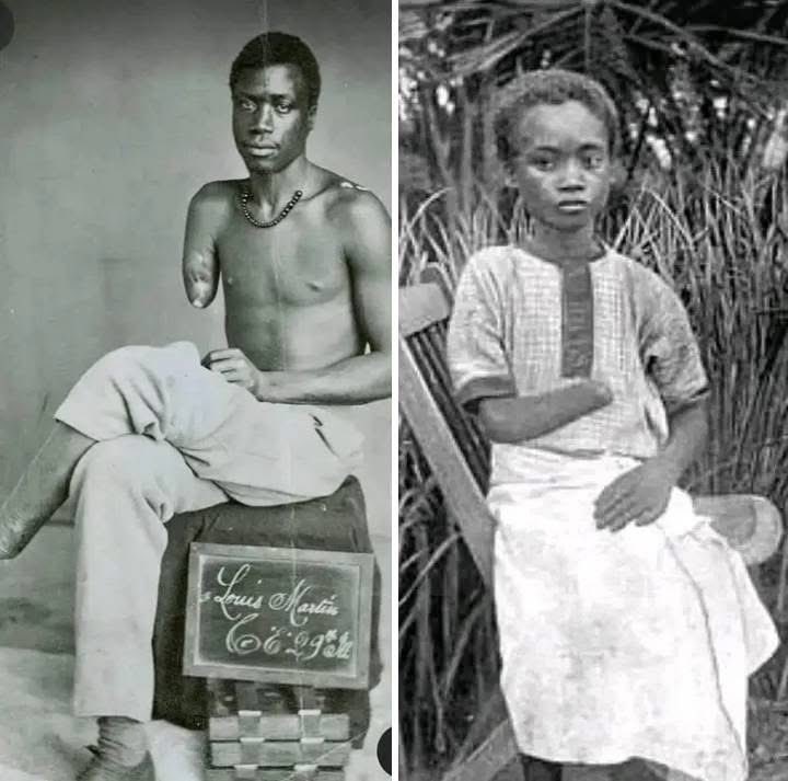 Joe__Bassey's tweet photo. Leopold, who was the colonial ruler  in Congo used to cut the limbs of Congolese people when they don’t produce the estimated rubber per day. At the end of his rule in Congo, he killed about 10 million Congolese by murdering them and also causing famine and starvation. Today, King Leopold who was a devoted Christian is celebrated in European history as a conqueror.