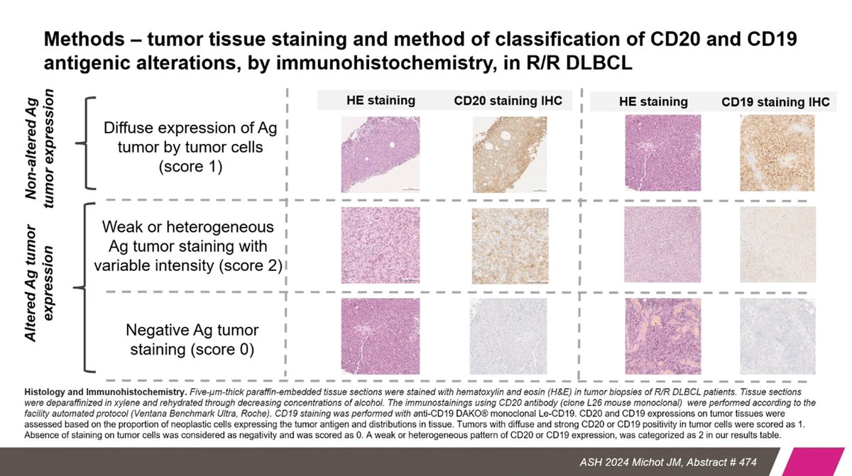 Fer_martinmoro's tweet photo. R/R DLBCL with CD20 and/or CD19 alterations. 

CD20:
- 26% alteration
- Worse OS in R/R DLBCL with altered CD20
- KLHL14 was found more frequently mutated in CD20 altered cases

CD19:
- 39% alteration
- 63% altered in post-CAR-T samples

#ASH24 #lymphoma https://t.co/kQjZSw6blO