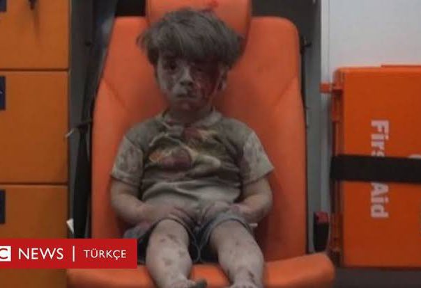 MMusaviDemir's tweet photo. Bu mazlum çocukların acısına hangi rejim dayanabilirdi ki ?
#FreeSyria https://t.co/ubGyAsPmIA