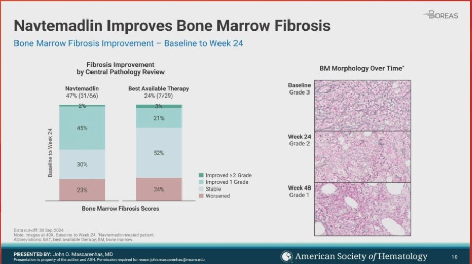 MPN_Hub's tweet photo. CONGRESS #ASH24 | PRESENTATION
John Mascarenhas, @IcahnMountSinai discussed results from the phase III BOREAS study. Navtemadlin treatment improved biomarkers of disease burden in pts with R/R MF, including  changes in CD34+ counts, driver mutation burden, and serum inflammatory cytokine levels. The POIESIS study will further investigate navtamadelin in pts with subotimal response to rux. Follow our live feed for more updates: https://t.co/NqDgLO6DlQ 
#MPN #MPNsm