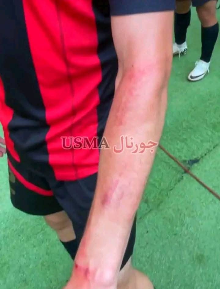 usmiste193716's tweet photo. Une attaque de supporters sénégalais contre les joueurs et supporters de l’USM Al-Capital, faisant de graves blessés dans les rangs de cette dernière
#CAFCC #CAFCL #usma #jaraf 
#إتحاد_العاصمة #جاراف #caf https://t.co/CrQfiKQTKJ