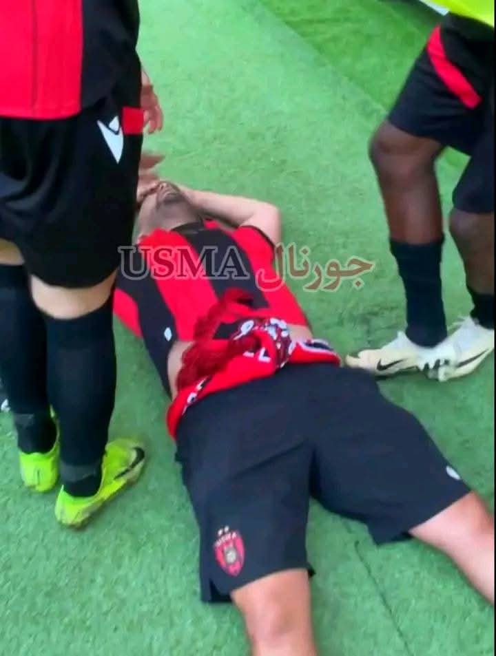 usmiste193716's tweet photo. Une attaque de supporters sénégalais contre les joueurs et supporters de l’USM Al-Capital, faisant de graves blessés dans les rangs de cette dernière
#CAFCC #CAFCL #usma #jaraf 
#إتحاد_العاصمة #جاراف #caf https://t.co/CrQfiKQTKJ