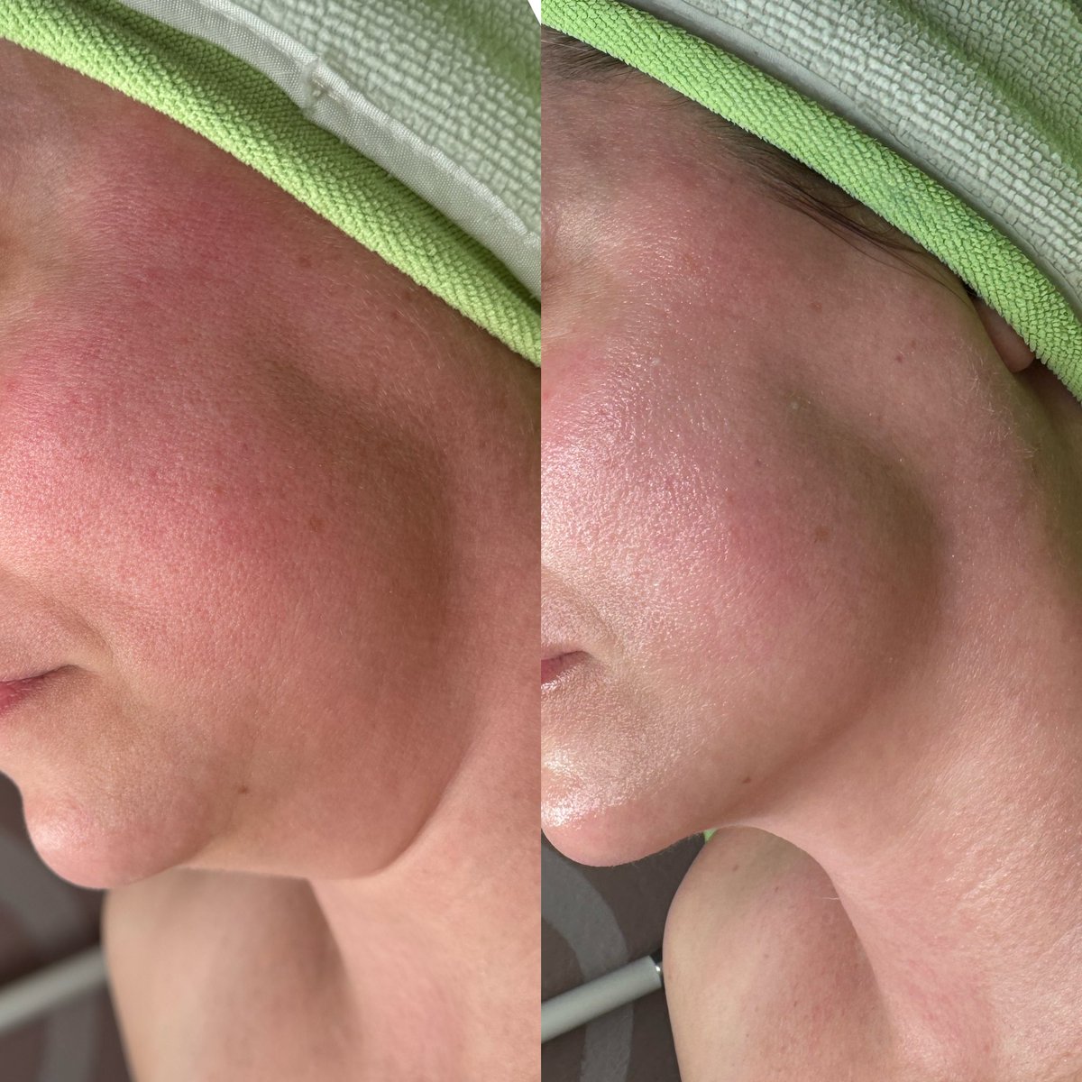 krenae_m's tweet photo. lymphatic drainage sunday 🙆🏻‍♀️ https://t.co/w0tpv0elCz