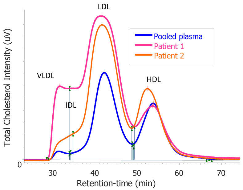 drpablocorral's tweet image. Severe Dyslipidemia Mimicking Familial Hypercholesterolemia Induced by High-Fat, Low-Carbohydrate Diets: A Critical Review

#LMHR #n=2 #peoplematter

“…both individuals adhering to these diets as well as their clinicians, should be cautious of their potential to cause or