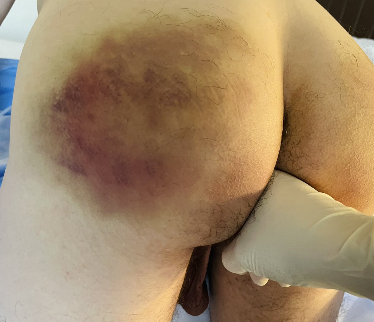 DocDavid_'s tweet photo. #maleexam #prostateexam #medfet https://t.co/ZaQEwkaJW5