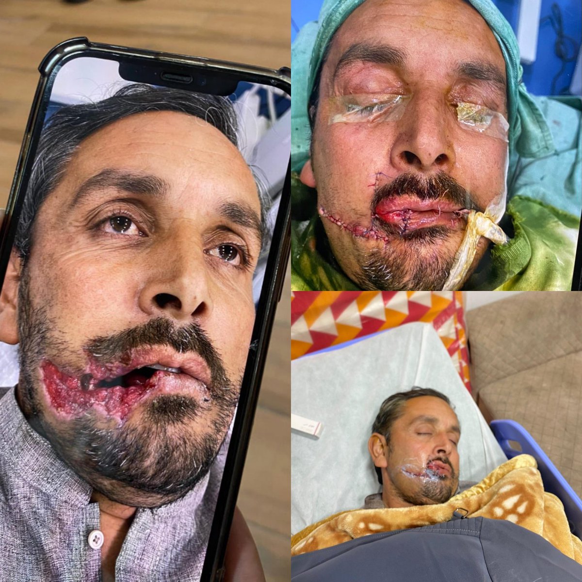 اجتماعی بد دعا کی ضرورت ہے🤲

یااللہ جس نے معصوم لوگوں کو گولیاں ماری شہید کیا زخمی کیا ان کی اولادں کو عبرت ناک موت نصیب کر امین