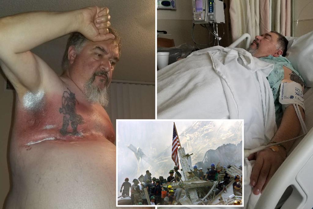 Number of men with breast cancer near NYC’s Ground Zero skyrockets — now 90 times national average trib.al/VAGp7iq
