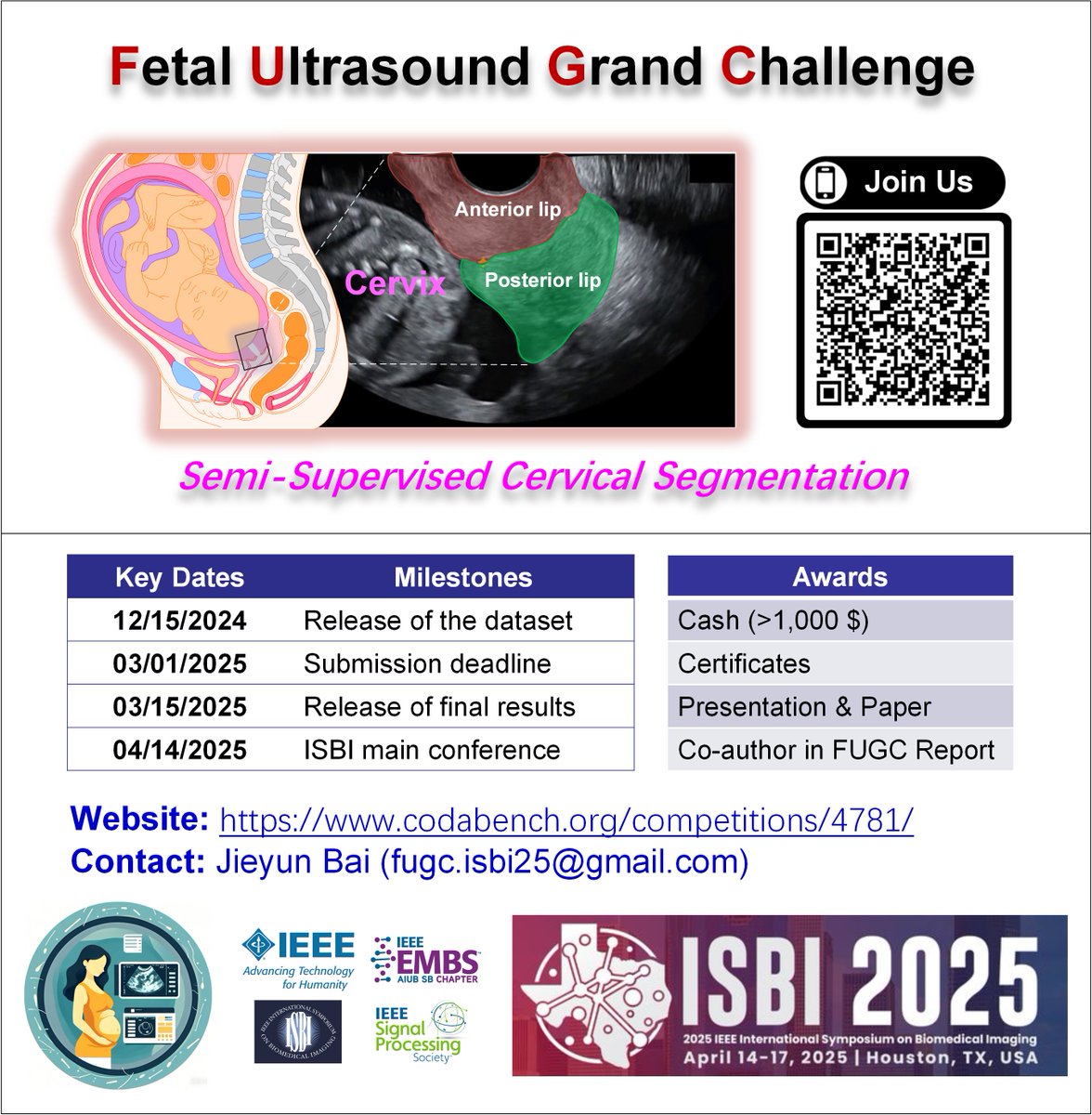 Jieyun Bai (@jieyun_auckland) on Twitter photo Fetal Ultrasound Grand Challenge under ISBI 2025. codabench.org/competitions/4…
<a href="/lena_maierhein/">Lena Maier-Hein New: @lena-maier-hein.bsky.social</a>
<a href="/IeeeIsbi/">IEEE International Symposium on Biomedical Imaging</a>
<a href="/FetalUltrasound/">Aris Papageorghiou</a>
<a href="/bias_sig/">MICCAI SIG for Challenges</a>
<a href="/KarimLekadir/">Karim Lekadir</a>
<a href="/MiccaiStudents/">MICCAI Students</a>
<a href="/SigUltrasound/">MICCAI SIG Ultrasound</a>
<a href="/ilkhch/">ilkhch</a> <a href="/MICCAI_Society/">MICCAI</a>
<a href="/yipenghu/">Yipeng Hu</a>
<a href="/IPCAI_conf/">IPCAI</a>
<a href="/AIUMultrasound/">AIUM Ultrasound</a>
<a href="/OBUltrasound/">OB Ultrasound</a>
<a href="/exoeffect/">Exo</a> Fetal Ultrasound Grand Challenge under ISBI 2025. codabench.org/competitions/4…
<a href="/lena_maierhein/">Lena Maier-Hein New: @lena-maier-hein.bsky.social</a>
<a href="/IeeeIsbi/">IEEE International Symposium on Biomedical Imaging</a>
<a href="/FetalUltrasound/">Aris Papageorghiou</a>
<a href="/bias_sig/">MICCAI SIG for Challenges</a>
<a href="/KarimLekadir/">Karim Lekadir</a>
<a href="/MiccaiStudents/">MICCAI Students</a>
<a href="/SigUltrasound/">MICCAI SIG Ultrasound</a>
<a href="/ilkhch/">ilkhch</a> <a href="/MICCAI_Society/">MICCAI</a>
<a href="/yipenghu/">Yipeng Hu</a>
<a href="/IPCAI_conf/">IPCAI</a>
<a href="/AIUMultrasound/">AIUM Ultrasound</a>
<a href="/OBUltrasound/">OB Ultrasound</a>
<a href="/exoeffect/">Exo</a>