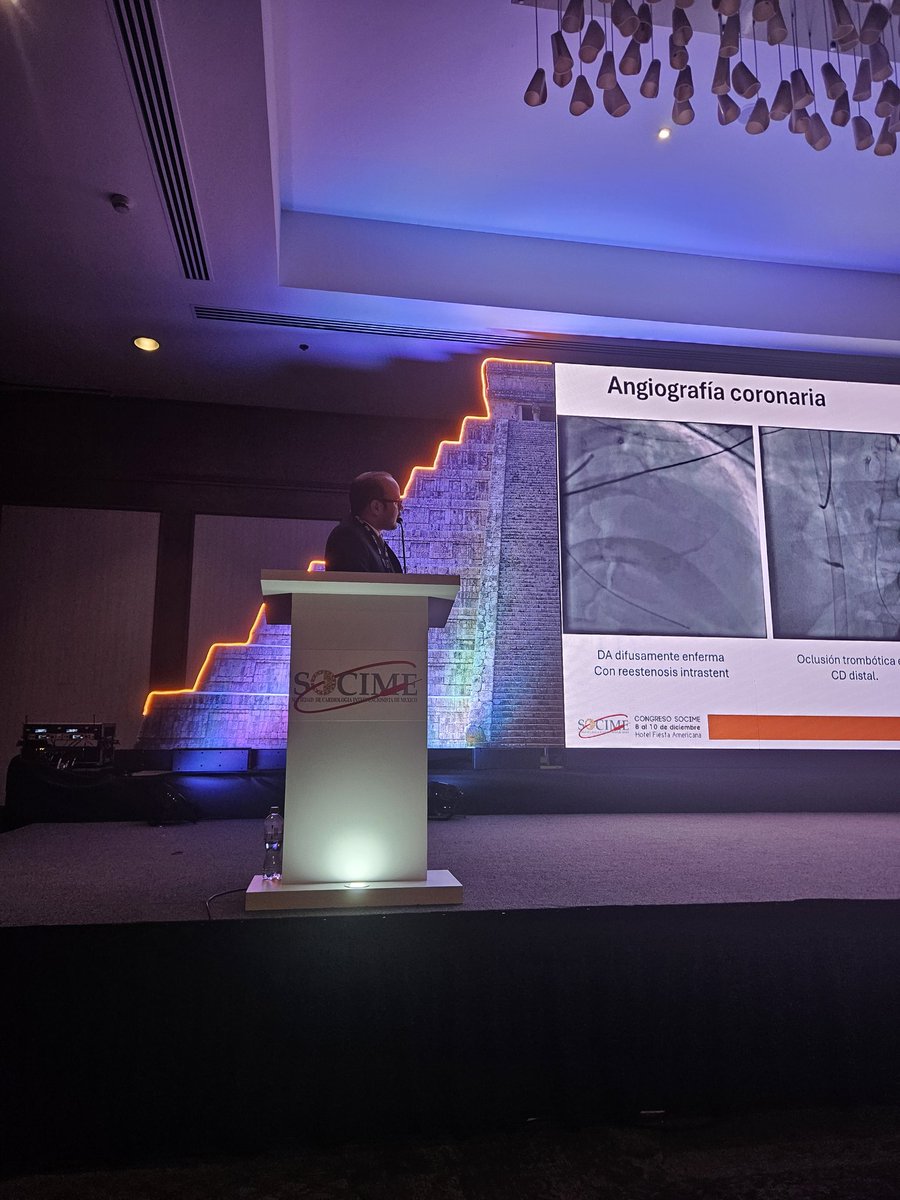 Gian Manuel Jmz Rdz (@drgianma) on Twitter photo Choque cardiogénico.
Intervenciones coronarias de alto riesgo.
#ECMO
#ECPELLA
#LAVAECMO
#cardiogenicshock
Excelente colaboración <a href="/PedroMDMSc/">Pedro Villablanca MD, MSc, FACC, FSCAI</a> <a href="/vicentejmzmd/">Vicente Jimenez-Franco MD 🇲🇽🫀</a> Choque cardiogénico.
Intervenciones coronarias de alto riesgo.
#ECMO
#ECPELLA
#LAVAECMO
#cardiogenicshock
Excelente colaboración <a href="/PedroMDMSc/">Pedro Villablanca MD, MSc, FACC, FSCAI</a> <a href="/vicentejmzmd/">Vicente Jimenez-Franco MD 🇲🇽🫀</a>