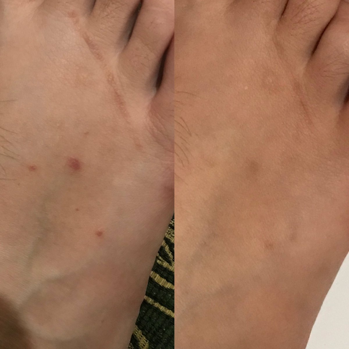 dafkive's tweet photo. punya bekas luka? kulit kering? kulit belang?

it’s a sign buat kmu cobain produk ini🫵 bekas lukaku memudar dan juga bikin lembab bgt! https://t.co/hQZyws2kUW