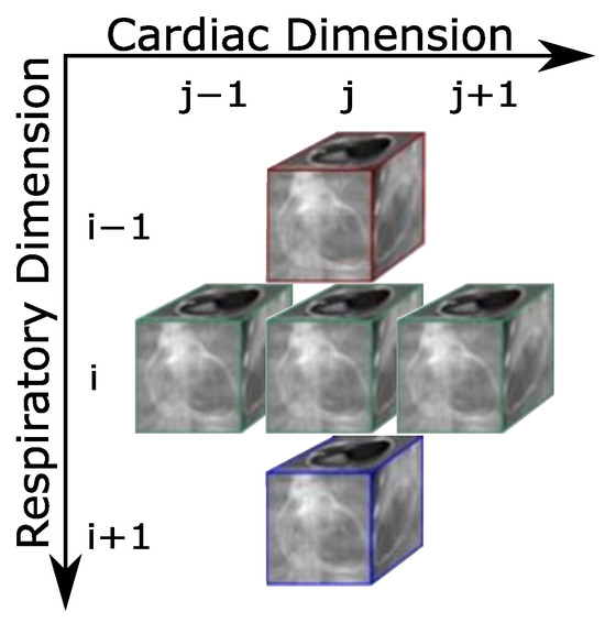 Sensors_MDPI's tweet image. Multi-Device Parallel MRI Reconstruction: Efficient Partitioning for Undersampled 5D Cardiac CINE
mdpi.com/1424-8220/24/4…
#parallelcomputing #MRI #compressedsensing