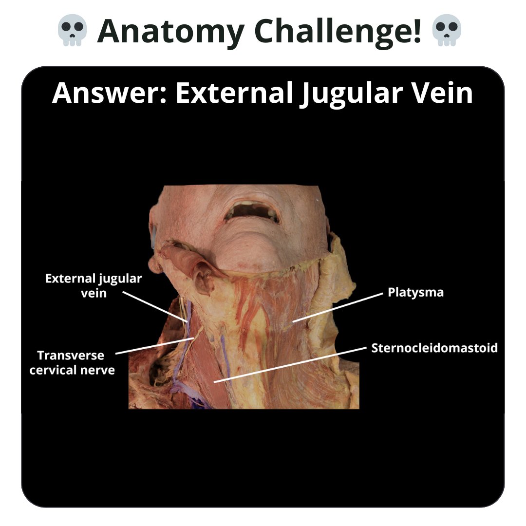 TeachMe_Support's tweet image. Anatomy challenge of the week 🏆 Can you name the structure? #quizyourself #meded #medschool #medicalstudent #medstudent #premed #premedlife #nursing #nursingschool #pastudent #physician #futuredoctor #studymotivation #medlife #surgery #medschoolmemes #medicalmeme
