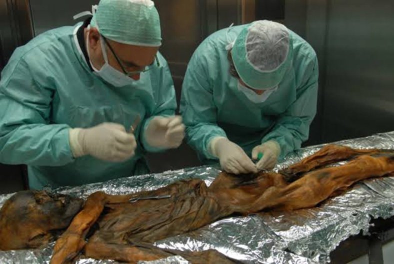 Kancalı Kurt parazitinin izlerine rastlandığı ortaya çıktı. Fakat asıl şaşırtıcı olan şey ise parazitleri öldürme özelliği taşıyan bir çeşit ağaç yosununun da Ötzi’nin bağırsaklarında bol miktarda bulunmuş olmasıdır.