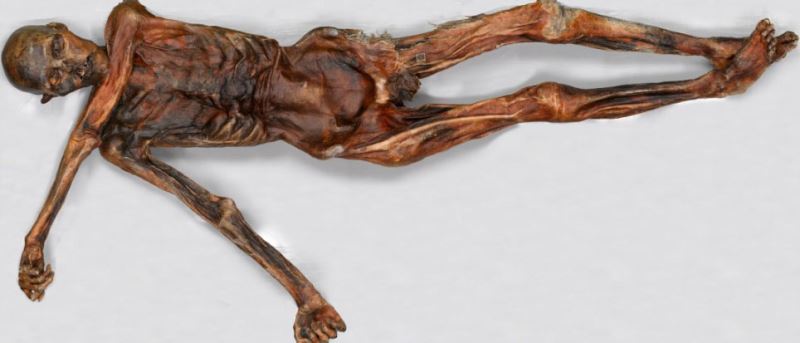 Ayrıca Ötzi’nin arka dişlerinden birinde muhtemelen yediği tahılların arasına karışmış olan bir taşın neden olduğu büyük bir kırık saptandı.
Araştırmacılar, Ötzi’nin yanında bir yay, 14 ok, bir bıçak ve bakır bir balta taşıdığını tespit ettiler.