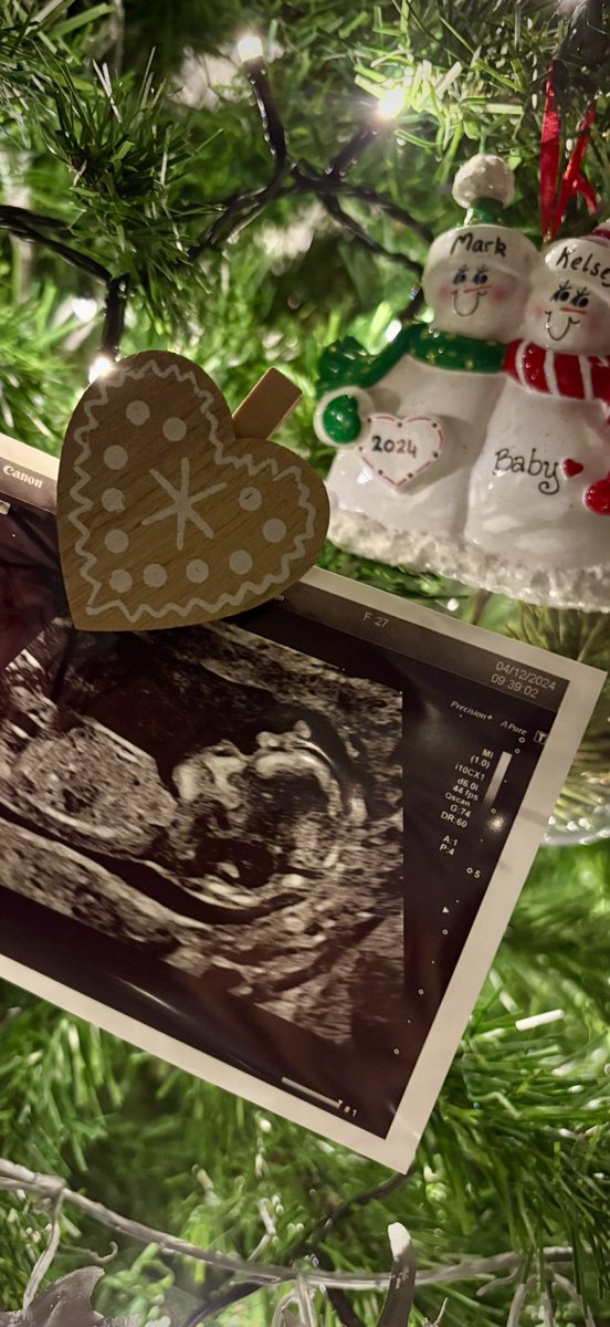 MarkColledge92's tweet image. Christmas is slightly different this year, with this hyperactive fur ball, but next Christmas will be super special 👶🏼🎄
