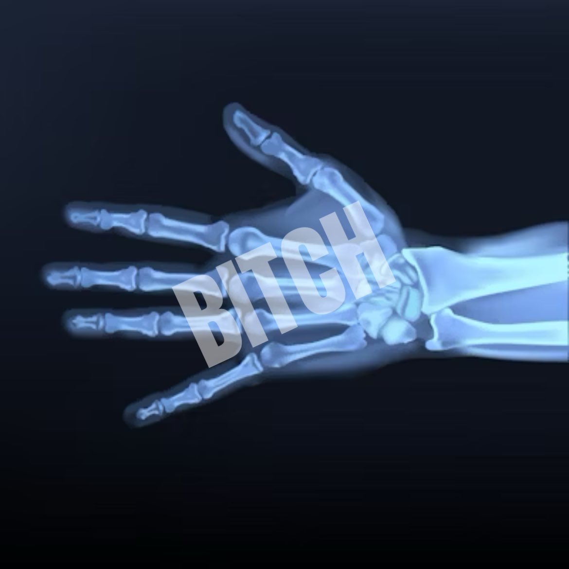 504Tru's tweet photo. Derek Carr hand xray leaked https://t.co/10pTiil9fR