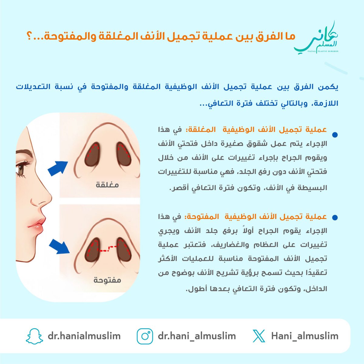 الفرق بين عملية تجميل الأنف الوظيفية المغلقة والمفتوحة...🧑‍⚕️👃💫

#مستشفى #عيادة #دكتور_تجميل #استشاري_تجميل #عملية_تجميل_الأنف #نصيحة #تجميل #تجميل_الانف #هاني_المسلم #جراحة #جراحة_تجميلية #عمليات_تجميل #تجميل_أنف #تجميل_الوجه #ترميم_الوجه #الطب_التجميلي #جراحة_تجميلية
