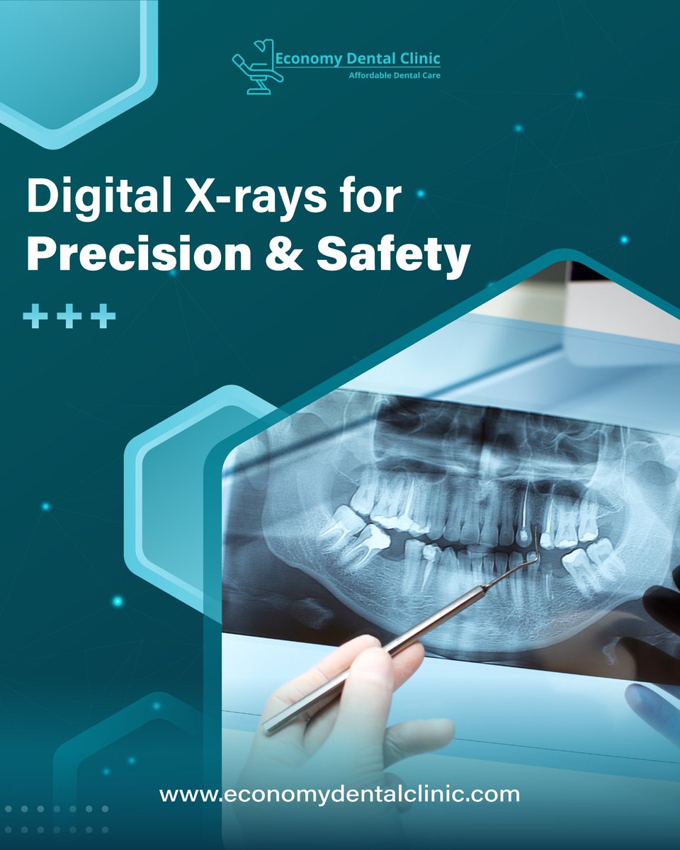 EconomyDentalTX's tweet image. At Economy Dental Clinic, we use the latest digital X-ray technology for precise dental diagnoses with 90% less radiation than traditional X-rays. Your safety is our priority! 🦷✨

📅 Schedule your appointment today and enjoy cutting-edge care!

#digitalxrays #dentalprecision