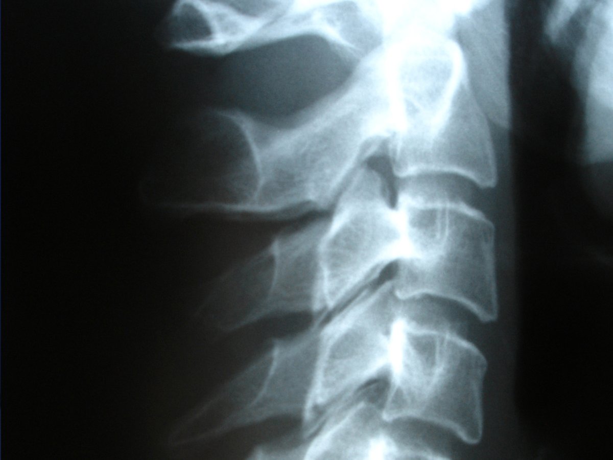 University of Suffolk (@uniofsuffolk) on Twitter photo Congratulations to our Diagnostic Radiography student, Jennifer McCarthy, who came fifth in the annual Insight Student Writing Competition run by <a href="/SoRStudents/">Society of Radiographers: Student Network</a> 👏
Find out more about our Diagnostic Radiography course: bit.ly/4ffzVYy
#HelloSuffolk #UniOfSuffolk Congratulations to our Diagnostic Radiography student, Jennifer McCarthy, who came fifth in the annual Insight Student Writing Competition run by <a href="/SoRStudents/">Society of Radiographers: Student Network</a> 👏
Find out more about our Diagnostic Radiography course: bit.ly/4ffzVYy
#HelloSuffolk #UniOfSuffolk