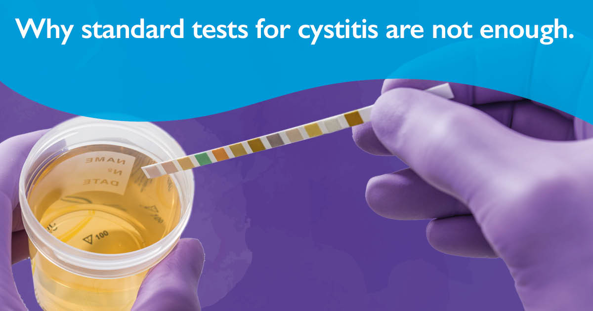 The NHS test dipstick urine test and routine urine culture are not always sensitive enough to diagnose acute or chronic cystitis. This test is based on criteria that have not changed since the 1950s, so if you are in any doubt, seek further testing. bladderhealthuk.org/page/index/294