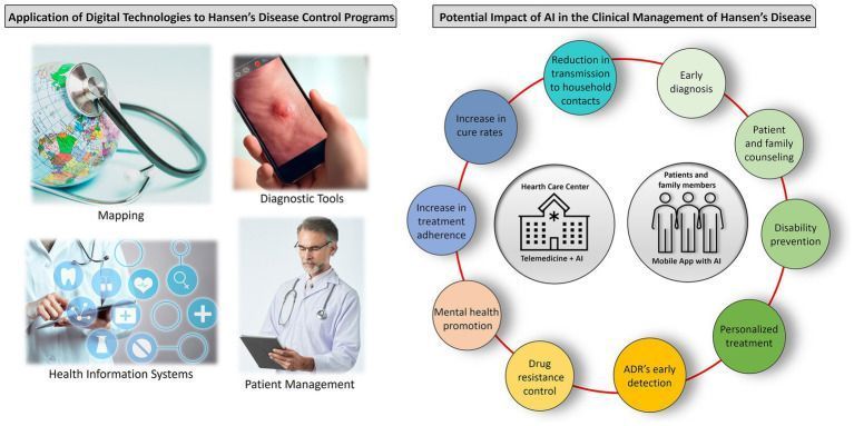 ISNTD_Press's tweet photo. The potential role of artificial intelligence in the clinical management of Hansen’s disease (leprosy)

Patrícia D. Deps

https://t.co/rWxr6jDqas

#ISNTD #NTD #Leprosy #PublicHealth #Eradication https://t.co/BQxWjA8mXr