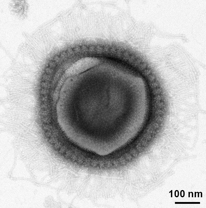 The Binder Lab (@thebinderlab) on Twitter photo Matthias Fischer <a href="/the_fischer_lab/">Matthias Fischer</a> is moving up North. While I am sad to see him leave beautiful Heidelberg, I am sure his new work environment <a href="/MarineMicrobio/">Max Planck Institute for Marine Microbiology</a> <a href="/maxplanckpress/">Max Planck Society</a> will be pitch perfect for his work in the fascinating world of protist viruses!
Want to join him? (1/2) Matthias Fischer <a href="/the_fischer_lab/">Matthias Fischer</a> is moving up North. While I am sad to see him leave beautiful Heidelberg, I am sure his new work environment <a href="/MarineMicrobio/">Max Planck Institute for Marine Microbiology</a> <a href="/maxplanckpress/">Max Planck Society</a> will be pitch perfect for his work in the fascinating world of protist viruses!
Want to join him? (1/2)
