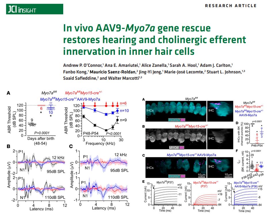 HearingShef's tweet photo. 🚨 Our latest paper has now been published in @JCI_insight, which shows that a single dual-AAV injection of Myo7a DNA restores some hearing function in Myo7a-deficient mice. 

#GeneTherapy #HearingShef

https://t.co/cS5sbsbvLn https://t.co/AR17m3dKxA