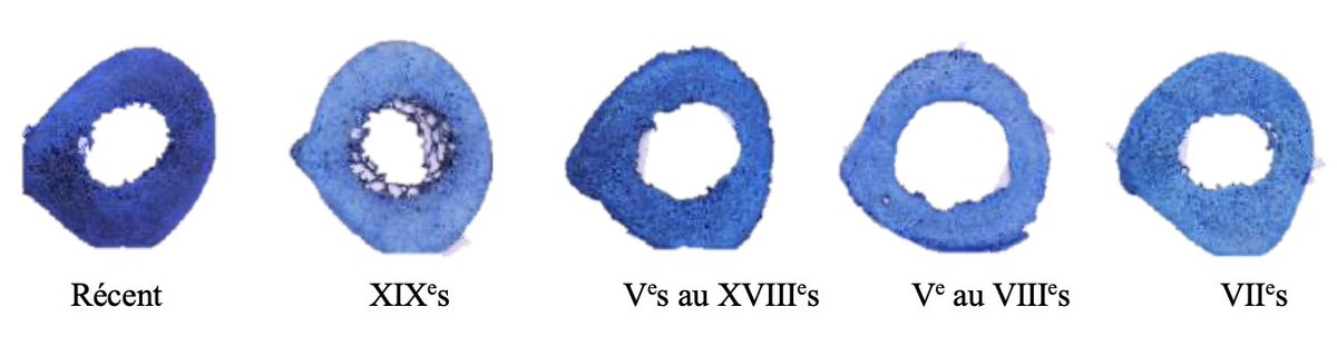 Unité de Taphonomie Médico-Légale & Anatomie tweet media