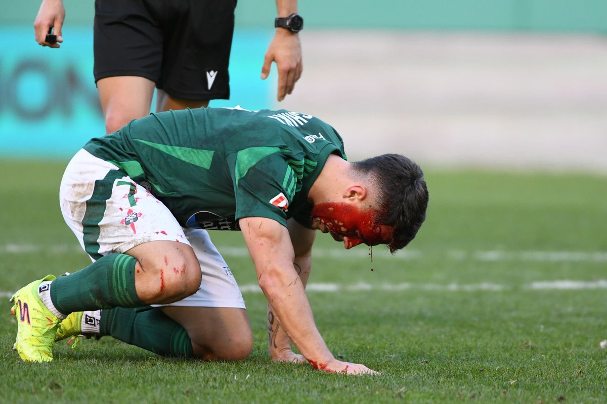 racingferrolsad's tweet image. Caemos xuntos.
Ergúemonos xuntos.

E nós xa caímos moitas veces como para saber que agora levantarémonos de novo.

#somosdeferro