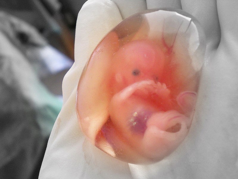 Smart1Doctor1's tweet photo. Abortion - 9 weeks
.
.
.
.
#abortion #9weekspregnant #womenshealth #reproductivehealth #healthcare #medicalawareness #pregnancy #abortionsupport #healthrights #familyplanning #sexualhealth #healthawareness https://t.co/pINBp5XypO