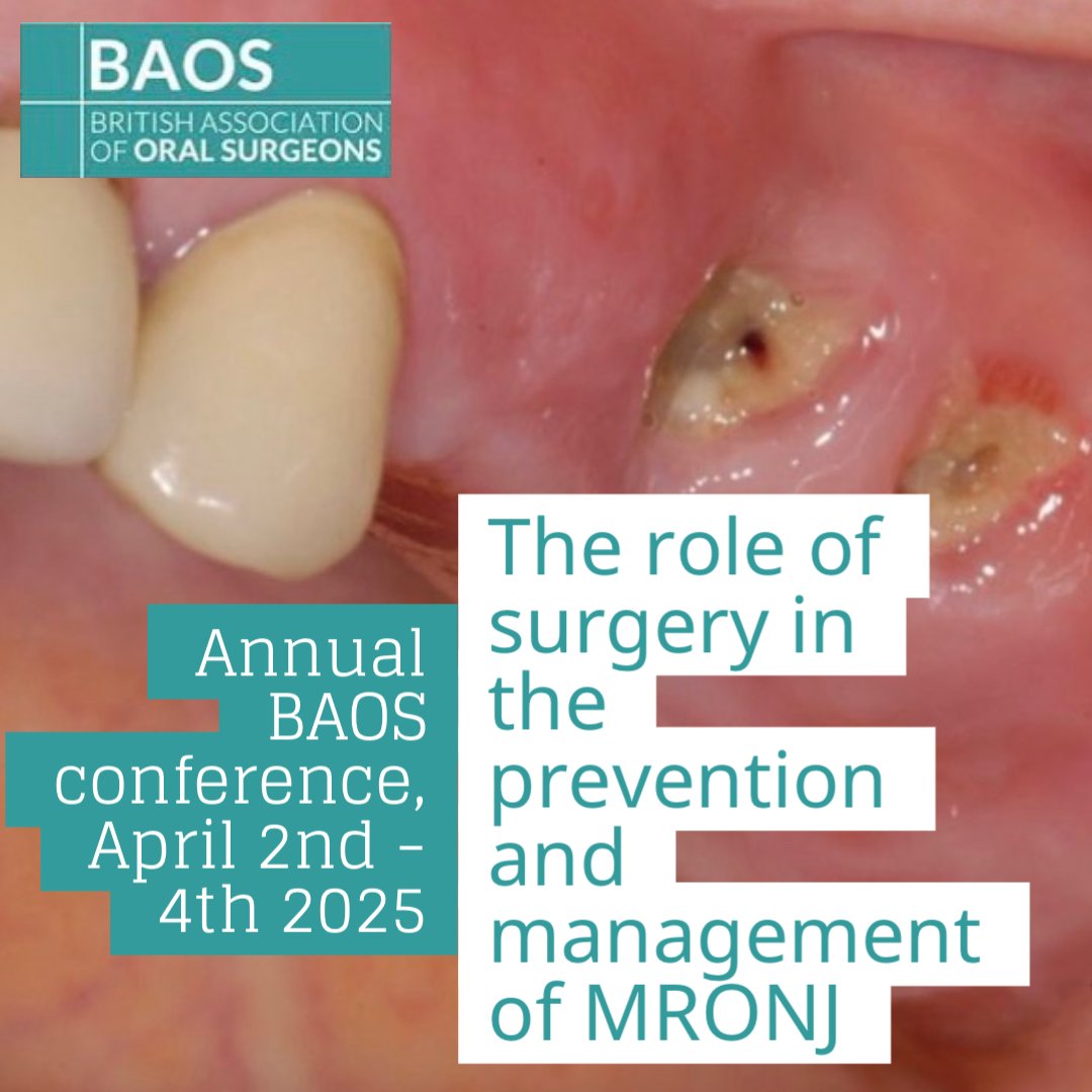 MRONJ - from prevention to treatment 💀

Dr Vinod Patel, Consultant Oral Surgeon, will be talking all things MRONJ at our annual conference in Newport, April 2025! 

Follow link to book, more info on our website ➡️ api.ripl.com/s/4uy68f

#OralSurgery #Dentistry #BAOSUK