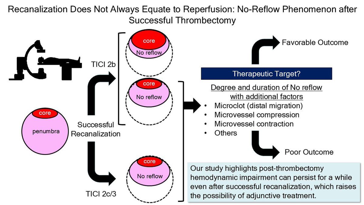 Recanalization Does Not Always Equate to Reperfusion: No-Reflow Phenomenon After Successful Thrombectomy | Stroke ahajournals.org/doi/abs/10.116…