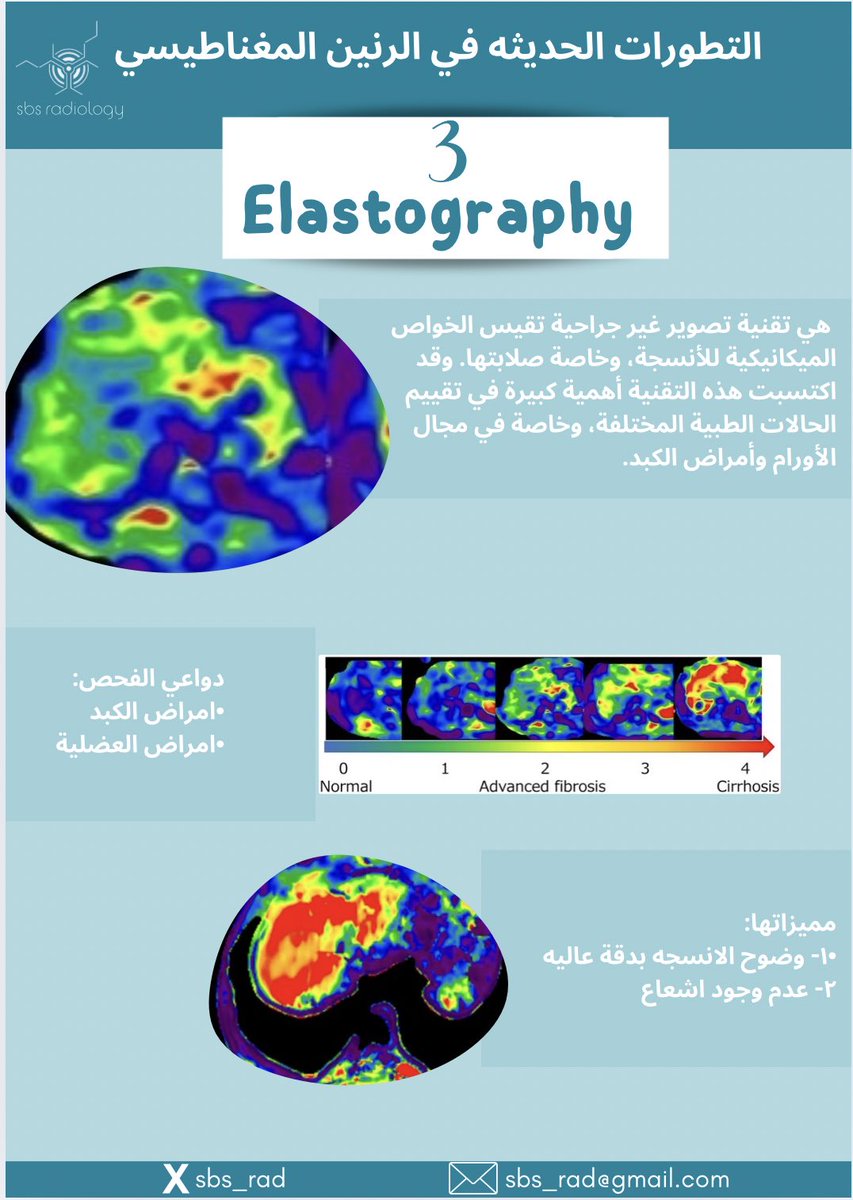 SBS Radiology tweet media