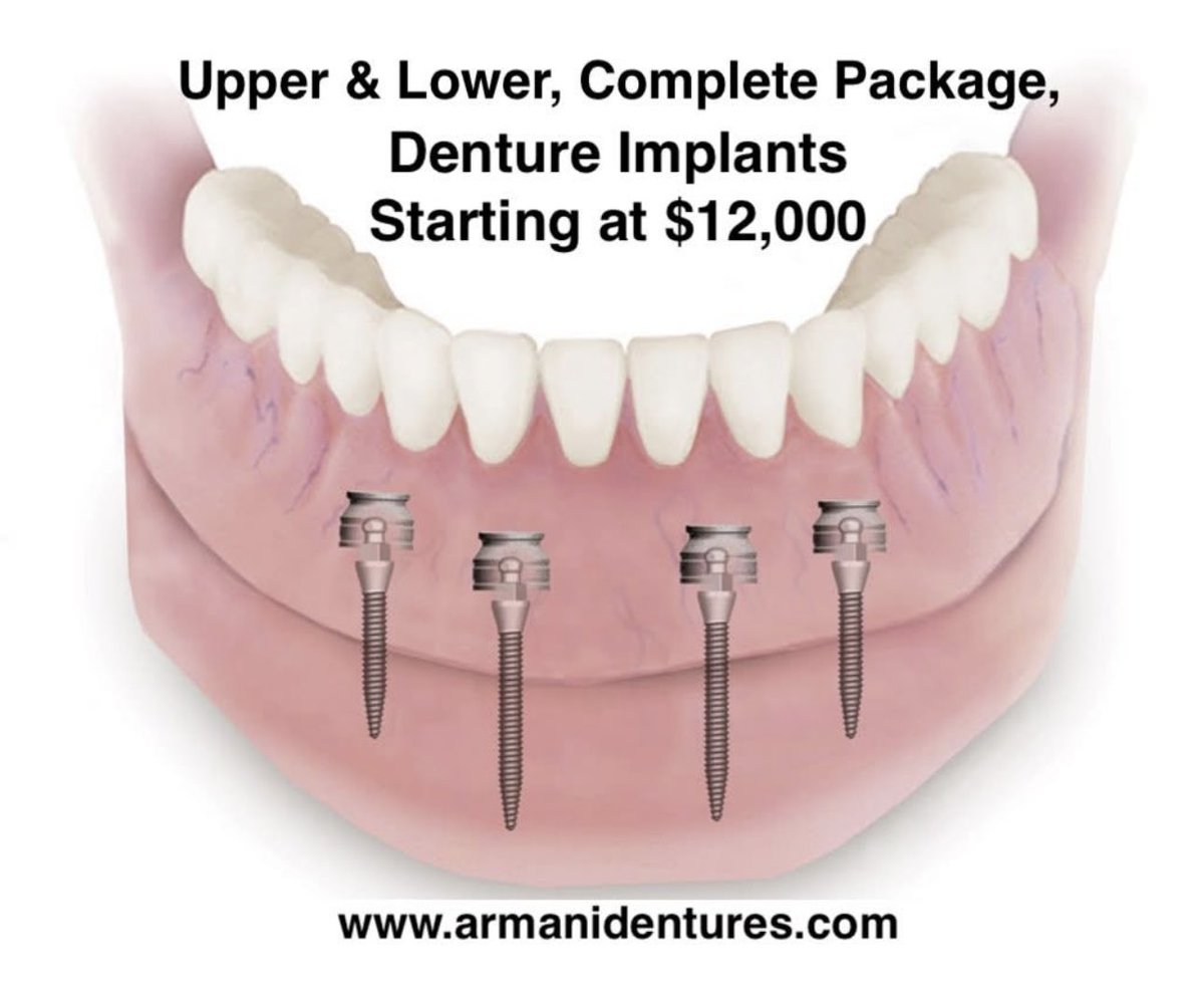 Same Day Service Upper &amp; Lower Starting at $ 24000.00