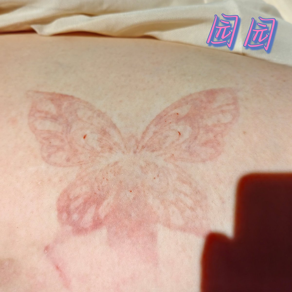 睡不着～
今天是超级完好无损腚😋～（出血点是因为最后五十藤条～）
给你们看俺爹给俺拍的翘翘腚🤪还有小蝴蝶印😬
#SP #小圈 #管教 #spanking       
#女贝
