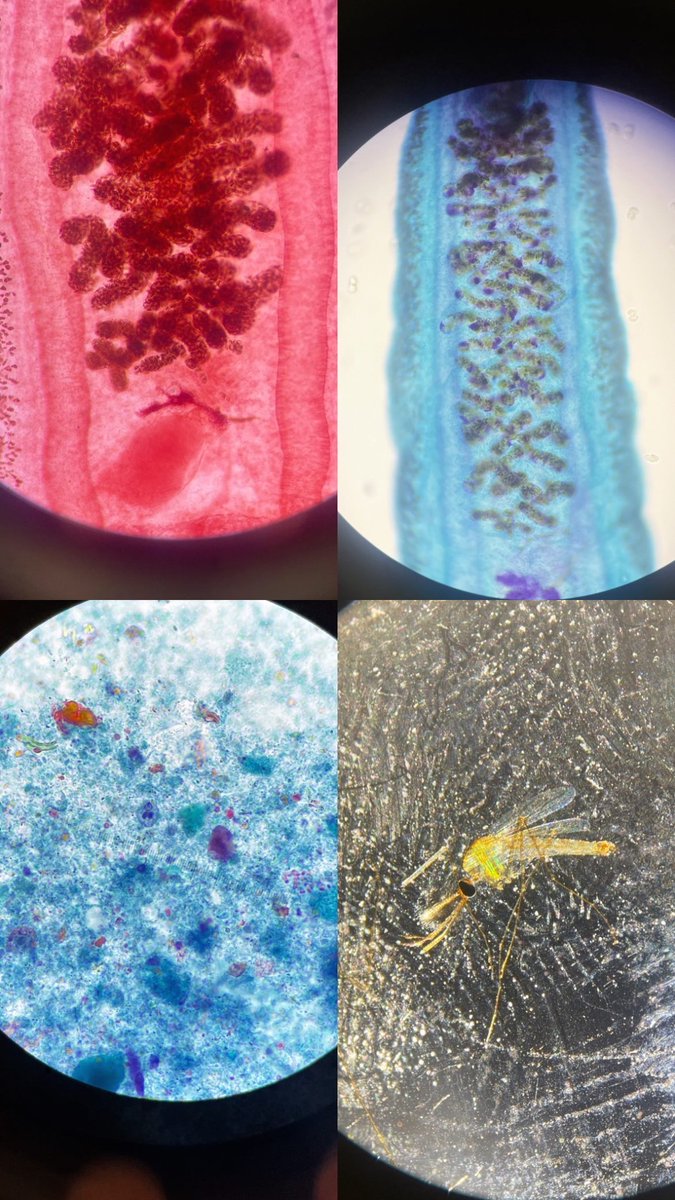 Great first day of microscopy <a href="/UofGlasgow/">University of Glasgow</a> ! #DTMH #Parasitology