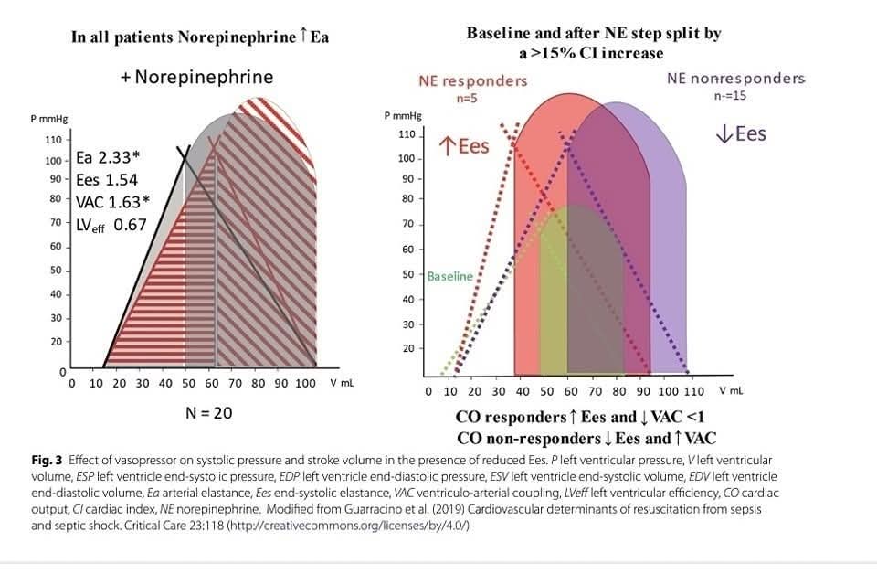 LeslieMegom's tweet photo. 💥⚡️🫁🫀Implicaciones fisiopatológicas del acoplamiento ventriculoarterial en el shock séptico📣
*Pinsky-Guarracino
👇👇👇👇👇
https://t.co/m18ucoocGs
🔑🔓
https://t.co/K9JcFD9JJQ https://t.co/oZvHpcYHIz