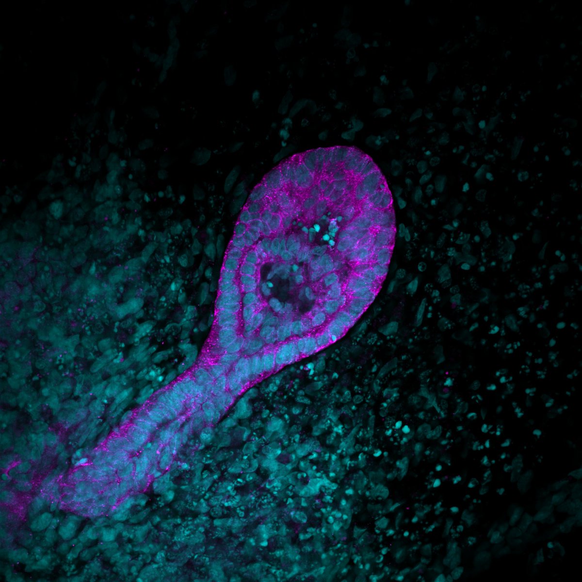 This kidney #organoid #nephron, captured by <a href="/cory_p_johnson/">Cory Johnson, PhD</a>, via the <a href="/MDIBL_LMF/">MDIBL_LMF</a>, is grown from human induced #PluripotentStemCells. Magenta marks the epithelial cells that line the inner side of tubules in the nephron &amp; cyan are nuclei of individual cells. #microscopymonday